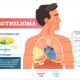 Malignant Pleural Mesothelioma Treatment