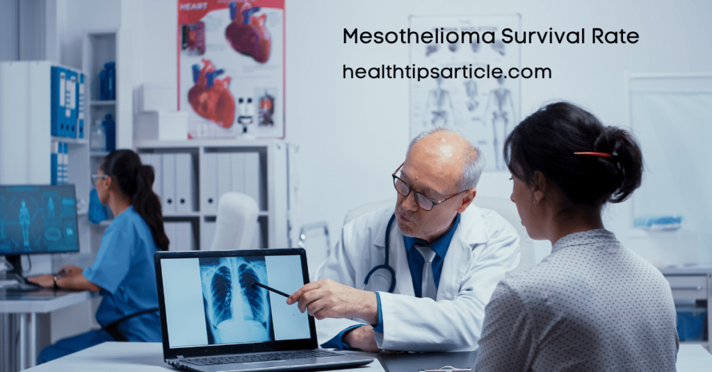 Mesothelioma Survival Rate - The Importance of Early Detection and Diagnosis